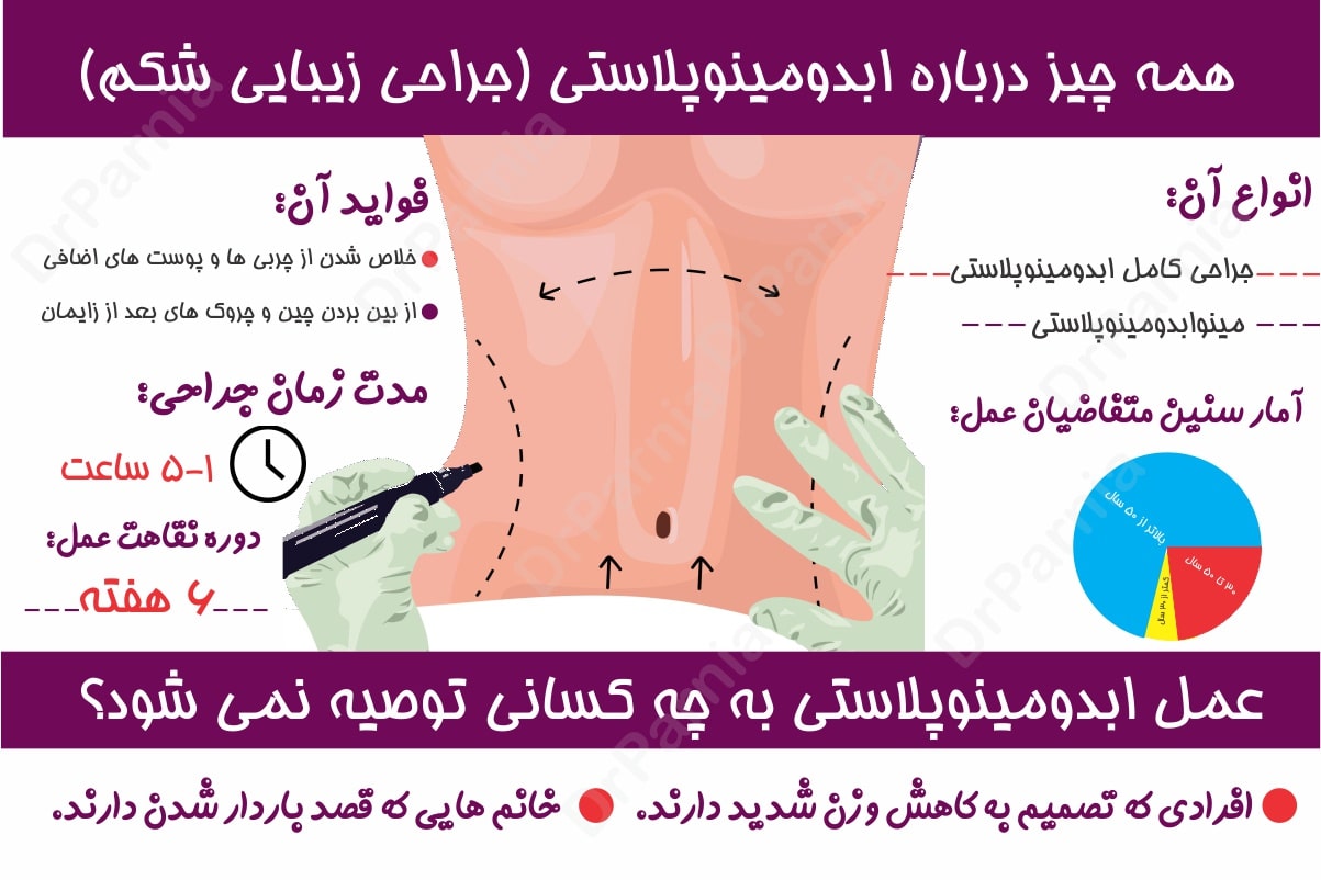 ابدومینوپلاستی یا تامی تاکی جراحی زیبایی شکم ابدومینوپلاستی یا تامی تاکی جراحی زیبایی شکم